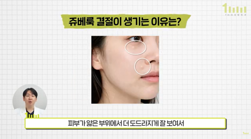 ما هي طرق الوقاية من عقيدات JUVÉLOOK؟ 1mm جراحة التجميل صورة 6