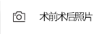 前后照片