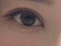 Dr. Do Eon-rok's Eye Revision Surgery Review