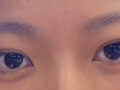 Dr. Do Eon-rok's Surgery Review