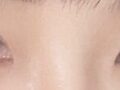 Review of Chief Director Do Eon-rok: Natural Adhesion + Upper Eyelid Surgery