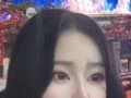 キム・ホンジン院長の額フィラー施術後期です！