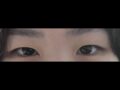 全切双眼+提肌    金洪振院长