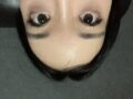 双眼皮修复