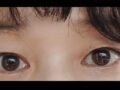 眉下切開
