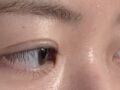 1mm Natural Adhesion + Upper Eyelid Lift
