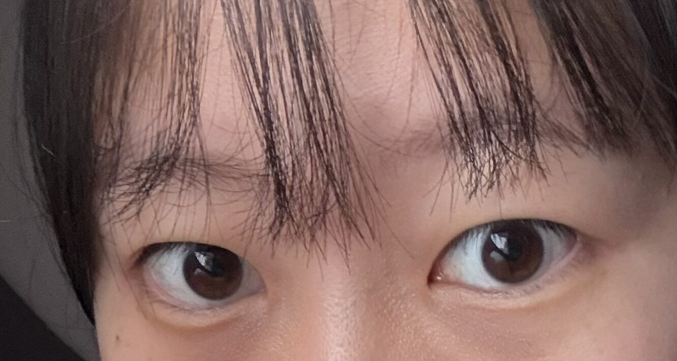 术前