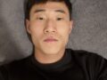 双眼皮手术+后眼角+眼睑下至