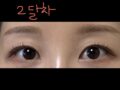 Dr. Kim Hong-jin's Natural Adhesion Success Story
