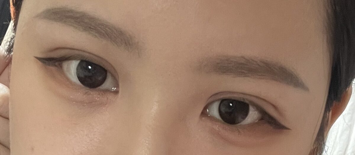 都彦禄代表院长（非切开式双眼皮手术）