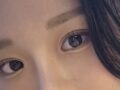I received natural adhesion + upper eyelid lift surgery at Ilmiri Plastic Surgery from Director Do Eon-rok.