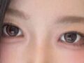 Non-incisional revision surgery by Director Do Eon-rok of 1mm Plastic Surgery