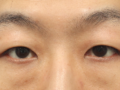 1mm整形外科+キム・ホンジン院長