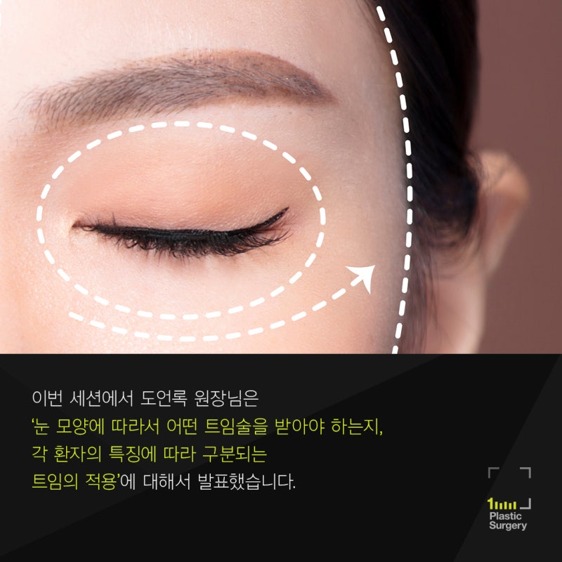 Dr. Do Eon-rok's 14th Oculoplastic Surgery Research Society Conference (Canthoplasty) 사진 4