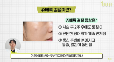 How to Prevent Juvelook Nodules? 1mm Plastic Surgery 사진 4