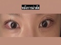 ศัลยกรรมแก้ไขเปลือกตาซ้อนและปรับรูปทรงดวงตา โดยผู้กำกับ โด ออน-ร็อก