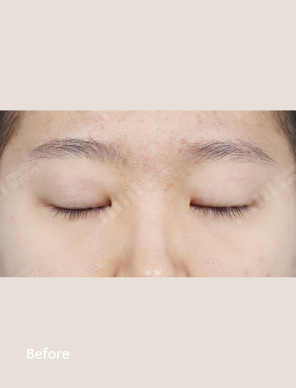 Before
