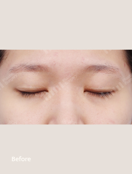 Before
