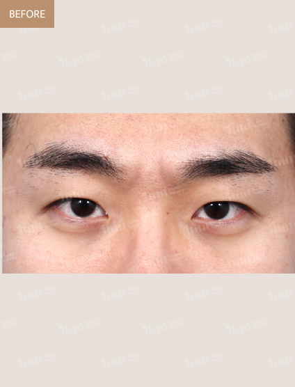 Before