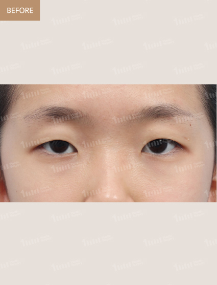 Before