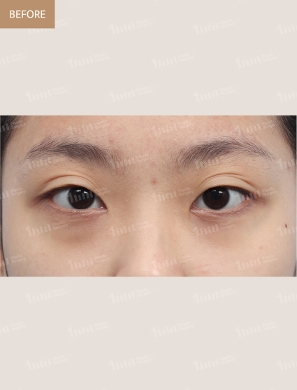 Before