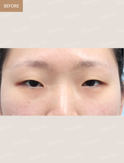 Before