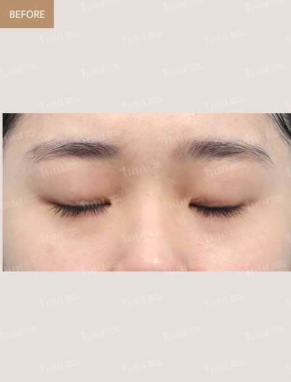 Before