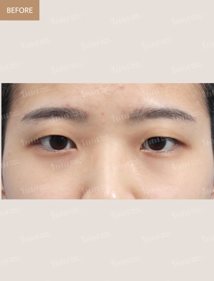 Before